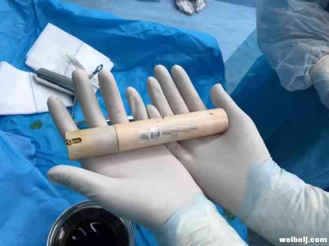 男子洗澡时不慎跌倒 致面霜棒插入肛门