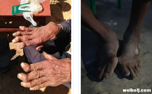 永胜六德乡整治醉酒酗酒，减贫成效显著