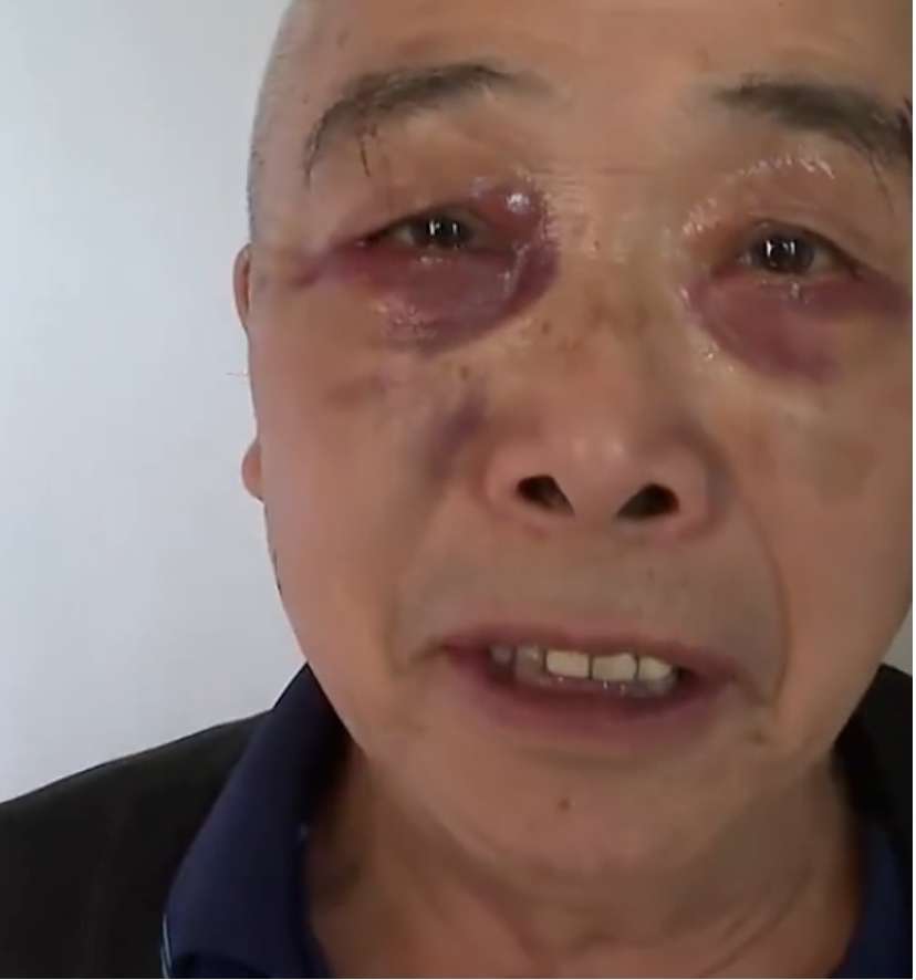 七旬老人晨练竟被忽悠割眼袋，涉事诊所回应引争议2.jpeg